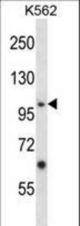 Mouse Epha4 Antibody western blot of K562 cell line lysates (35 ug/lane). The Epha4 antibody detected the Epha4 protein (arrow).