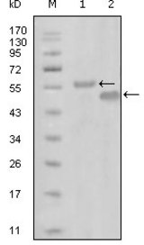 Western blot using EphA6 mouse monoclonal antibody against truncated MBP-EphA6 recombinant protein (1) and truncated GST-EphA6(aa695-795) recombinant protein (2).