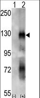 Western blot of EphA6 (arrow) using rabbit polyclonal EphA6 Antibody. 293 cell lysates (2 ug/lane) either nontransfected (Lane 1) or transiently transfected with the EPHA6 gene (Lane 2) (Origene Technologies).