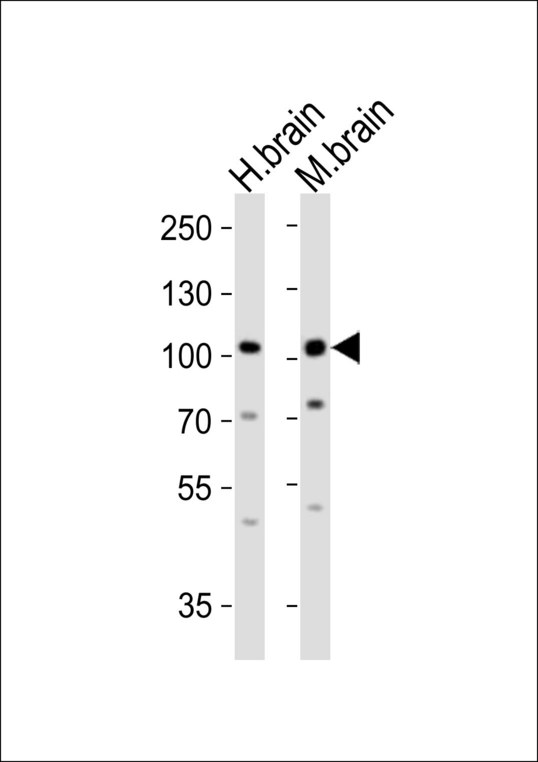 Western blot of lysates from human brain and mouse brain tissue (from left to right) with Epha6 Antibody. Antibody was diluted at 1:1000 at each lane. A goat anti-rabbit IgG H&L (HRP) at 1:10000 dilution was used as the secondary antibody. Lysates at 20 ug per lane.