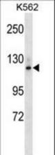 Mouse Epha7 Antibody western blot of K562 cell line lysates (35 ug/lane). The Epha7 antibody detected the Epha7 protein (arrow).