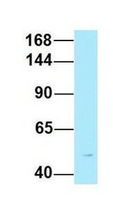 EPHA7 antibody Western Blot of Human Fetal Liver. Antibody Dilution: 1.0 ug/ml. Antibody dilution: 1 ug/ml.