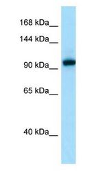 EPHA7 antibody Western Blot of OVCAR-3.