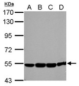 Eph Receptor A8 antibody [N1N2], N-term detects EPHA8 protein by Western blot analysis. A. 30 ug U87-MG whole cell lysate/extract. B. 30 ug SK-N-SH whole cell lysate/extract. C. 30 ug IMR32 whole cell lysate/extract. D. 30 ug SK-N-AS whole cell lysate/extract. 7.5 % SDS-PAGE. Eph Receptor A8 antibody [N1N2], N-term dilution:1:1000