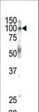 Western blot of anti-EphB1 antibody in mouse brain tissue. EphB1 (arrow) was detected using purified antibody. Secondary HRP-anti-rabbit was used for signal visualization with chemiluminescence.