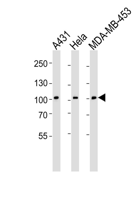 Western blot of lysates from A431, HeLa, MDA-MB-453 cell line (from left to right), using EPHB1 Antibody (H970). Antibody was diluted at 1:1000 at each lane. A goat anti-rabbit IgG H&L (HRP) at 1:5000 dilution was used as the secondary antibody. Lysates at 35ug per lane.
