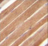 EphB2 Antibody immunohistochemistry of formalin-fixed and paraffin-embedded human skeletal muscle followed by peroxidase-conjugated secondary antibody and DAB staining.