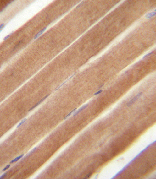 EphB2 Antibody immunohistochemistry of formalin-fixed and paraffin-embedded human skeletal muscle followed by peroxidase-conjugated secondary antibody and DAB staining.