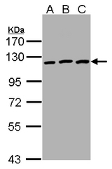 Sample(30g of whole cell lysate). A: HeLa. B: Hep G2. C: MOLT-4. 7.5% SDS PAGE. EPHB3 antibody diluted at 1:1000
