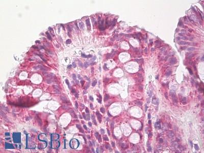 Anti-EPHB3 antibody IHC of human colon, epithelium. Immunohistochemistry of formalin-fixed, paraffin-embedded tissue after heat-induced antigen retrieval. Antibody LS-B8266 dilution 5-10 ug/ml.