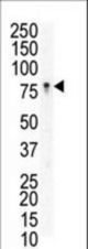 Western blot of anti-EphB3 N-term antibody in Jurkat cell lysate. EphB3 (arrow) was detected using purified antibody. Secondary HRP-anti-rabbit was used for signal visualization with chemiluminescence.
