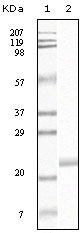 Western blot using EphB4 mouse monoclonal antibody against truncated EphB4 recombinant protein.