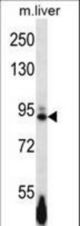 Mouse Ephb4 Antibody western blot of mouse liver tissue lysates (35 ug/lane). The Ephb4 antibody detected the Ephb4 protein (arrow).