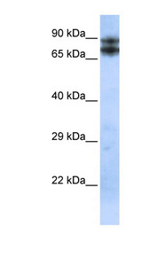 LIMA1 / EPLIN antibody LS-C109972 Western blot of Placenta lysate.