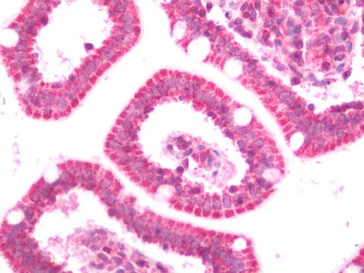 Human Small Intestine: Formalin-Fixed, Paraffin-Embedded (FFPE)