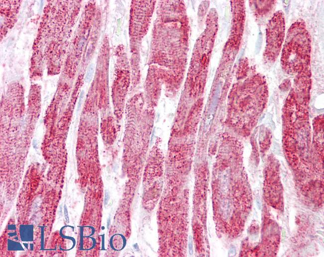 Anti-EPM2A antibody IHC of human heart. Immunohistochemistry of formalin-fixed, paraffin-embedded tissue after heat-induced antigen retrieval. Antibody LS-B6474 concentration 2.5 ug/ml.