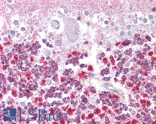 Anti-EPM2A antibody IHC of human brain, cerebellum. Immunohistochemistry of formalin-fixed, paraffin-embedded tissue after heat-induced antigen retrieval. Antibody LS-B6474 concentration 2.5 ug/ml.