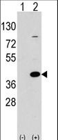 Western blot of EPM2A (arrow) using rabbit polyclonal EPM2A Antibody. 293 cell lysates (2 ug/lane) either nontransfected (Lane 1) or transiently transfected with the EPM2A gene (Lane 2) (Origene Technologies).