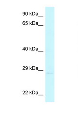 CHMP4A antibody LS-C145581 Western blot of 721_B Cell lysate. Antibody concentration 1 ug/ml.