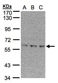 Sample (30 ug of whole cell lysate). A:293T, B: A431, C: H1299. 7.5% SDS PAGE. EPM2AIP1 antibody diluted at 1:500