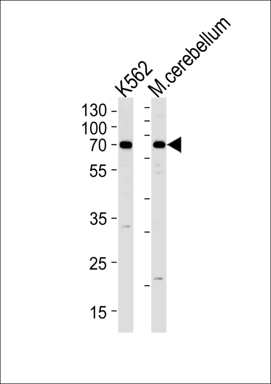 EPM2AIP1 Antibody western blot of K562 cell line and mouse cerebellum tissue lysates (35 ug/lane). The EPM2AIP1 antibody detected the EPM2AIP1 protein (arrow).