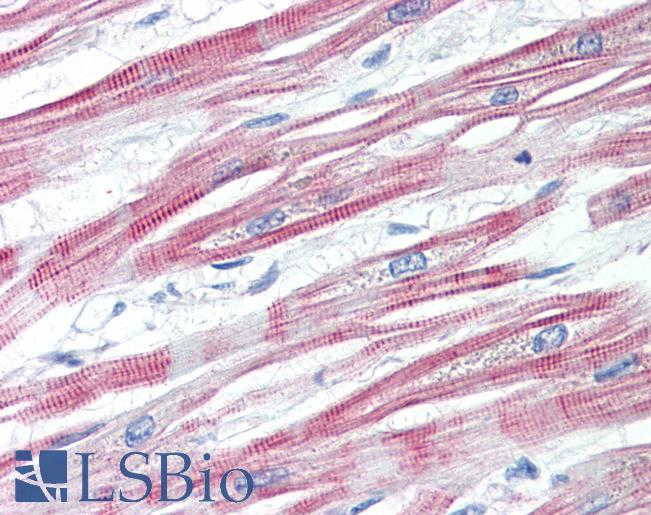 Anti-EPM2AIP1 antibody IHC staining of human heart. Immunohistochemistry of formalin-fixed, paraffin-embedded tissue after heat-induced antigen retrieval.