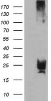 HEK293T cells were transfected with the pCMV6-ENTRY control (Left lane) or pCMV6-ENTRY CMPK1 (Right lane) cDNA for 48 hrs and lysed. Equivalent amounts of cell lysates (5 ug per lane) were separated by SDS-PAGE and immunoblotted with anti-CMPK1.
