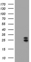 HEK293T cells were transfected with the pCMV6-ENTRY control (Left lane) or pCMV6-ENTRY CMPK1 (Right lane) cDNA for 48 hrs and lysed. Equivalent amounts of cell lysates (5 ug per lane) were separated by SDS-PAGE and immunoblotted with anti-CMPK1.