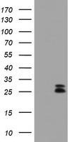 HEK293T cells were transfected with the pCMV6-ENTRY control (Left lane) or pCMV6-ENTRY CMPK1 (Right lane) cDNA for 48 hrs and lysed. Equivalent amounts of cell lysates (5 ug per lane) were separated by SDS-PAGE and immunoblotted with anti-CMPK1.