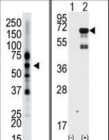 The anti-Epsin2 antibody is used in Western blot to detect Epsin2 in mouse brain tissue lysate.