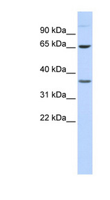 EPN2 antibody LS-C111655 Western blot of 293T cell lysate.