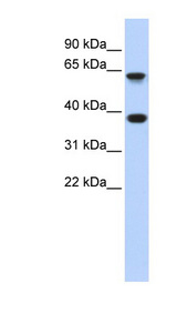 EPN2 antibody LS-C111656 Western blot of Fetal Brain lysate.