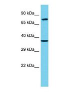 Western blot of EPN3 Antibody - C-terminal region with human 293T cells lysate.