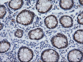 IHC of paraffin-embedded Human colon tissue using anti-CMPK1 mouse monoclonal antibody. (Heat-induced epitope retrieval by 10mM citric buffer, pH6.0, 100C for 10min).