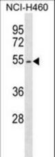 EPOR Antibody western blot of NCI-H460 cell line lysates (35 ug/lane). The EPOR antibody detected the EPOR protein (arrow).