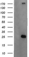 HEK293T cells were transfected with the pCMV6-ENTRY control (Left lane) or pCMV6-ENTRY CMPK1 (Right lane) cDNA for 48 hrs and lysed. Equivalent amounts of cell lysates (5 ug per lane) were separated by SDS-PAGE and immunoblotted with anti-CMPK1.