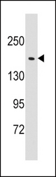 Western blot of anti-EPRS antibody in Jurkat cell line lysates (35 ug/lane). EPRS (arrow) was detected using the purified antibody.