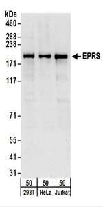 Detection of Human EPRS by Western Blot. Samples: Whole cell lysate (50 ug) from 293T, HeLa, and Jurkat cells. Antibodies: Affinity purified rabbit anti-EPRS antibody used for WB at 0.1 ug/ml. Detection: Chemiluminescence with an exposure time of 10 seconds.