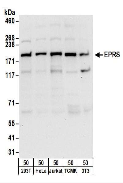 Detection of Human and Mouse EPRS by Western Blot. Samples: Whole cell lysate (50 ug) from 293T, HeLa, Jurkat, mouse TCMK-1, and mouse NIH3T3 cells. Antibodies: Affinity purified rabbit anti-EPRS antibody used for WB at 0.1 ug/ml. Detection: Chemiluminescence with an exposure time of 10 seconds.