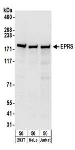 Detection of Human EPRS by Western Blot. Samples: Whole cell lysate (50 ug) from 293T, HeLa, and Jurkat cells. Antibodies: Affinity purified rabbit anti-EPRS antibody used for WB at 0.1 ug/ml. Detection: Chemiluminescence with an exposure time of 10 seconds.