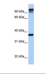 721_B cell lysate. Antibody concentration: 1.0 ug/ml. Gel concentration: 12%.