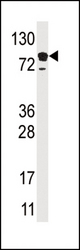Western blot of anti-EPS15 antibody in HL60 cell line lysate (35 ug/lane). EPS15 (arrow) was detected using the purified antibody.