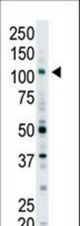 The anti-EPS15R antibody is used in Western blot to detect EPS15R in Y79 cell lysate.