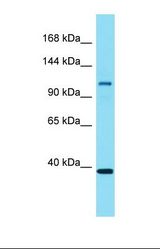 Western blot of Mouse Spleen. Eps15l1 antibody dilution 1.0 ug/ml.