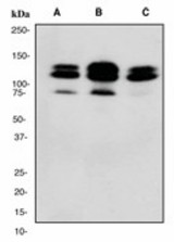 Western blot analysis on (A) HeLa (B) 293T and (C) SHSY5Y cell lysates using anti-EPS15R antibody (LS-C105354), dilution 1:20000.