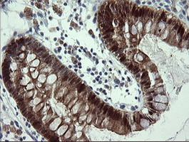 IHC of paraffin-embedded Human colon tissue using anti-CMPK1 mouse monoclonal antibody.