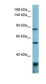 EPS8 antibody LS-C107741 Western blot of ACHN lysate.