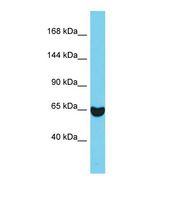 Western blot of Mouse Lung . Eps8 antibody dilution 1.0 ug/ml.