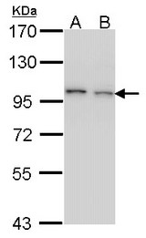 Sample (30 ug of whole cell lysate). A: H1299, B: Hela. 7.5% SDS PAGE. EPS8 antibody. EPS8 antibody diluted at 1:1000.