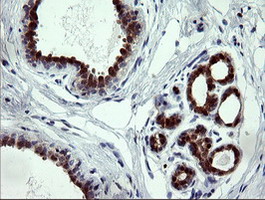 IHC of paraffin-embedded Human breast tissue using anti-CMPK1 mouse monoclonal antibody.